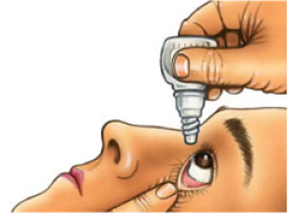 Como colocarse CORRECTAMENTE los colirios.