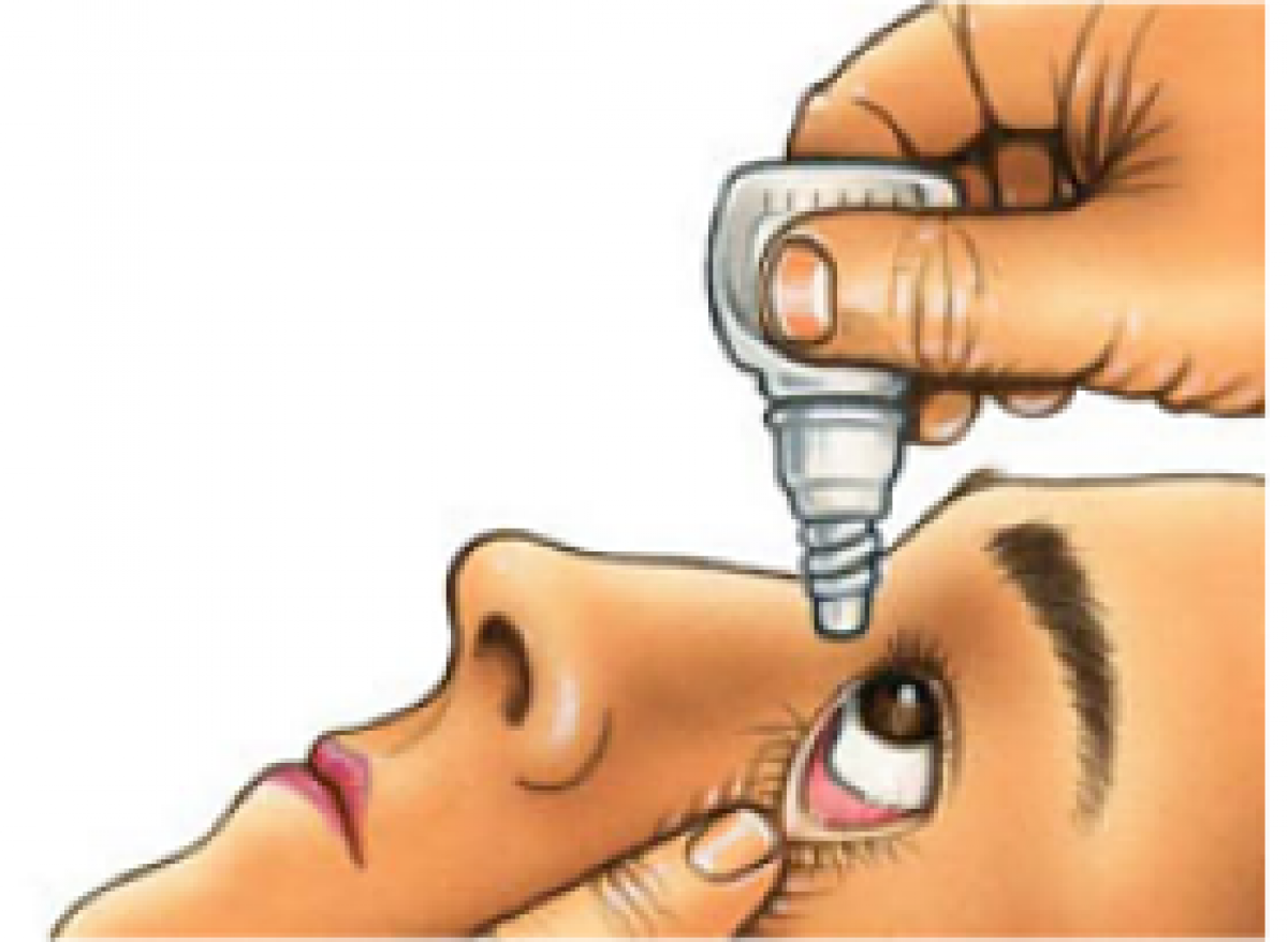 Como colocarse CORRECTAMENTE los colirios.